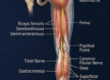 Anatomical chart of the sciatic nerve and muscles of the leg